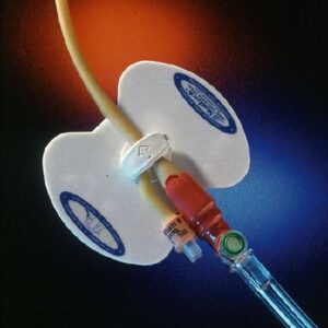 Catheter Stabilization Device Statlock? Adult, Foam Anchor Pad, Perspiration Holes